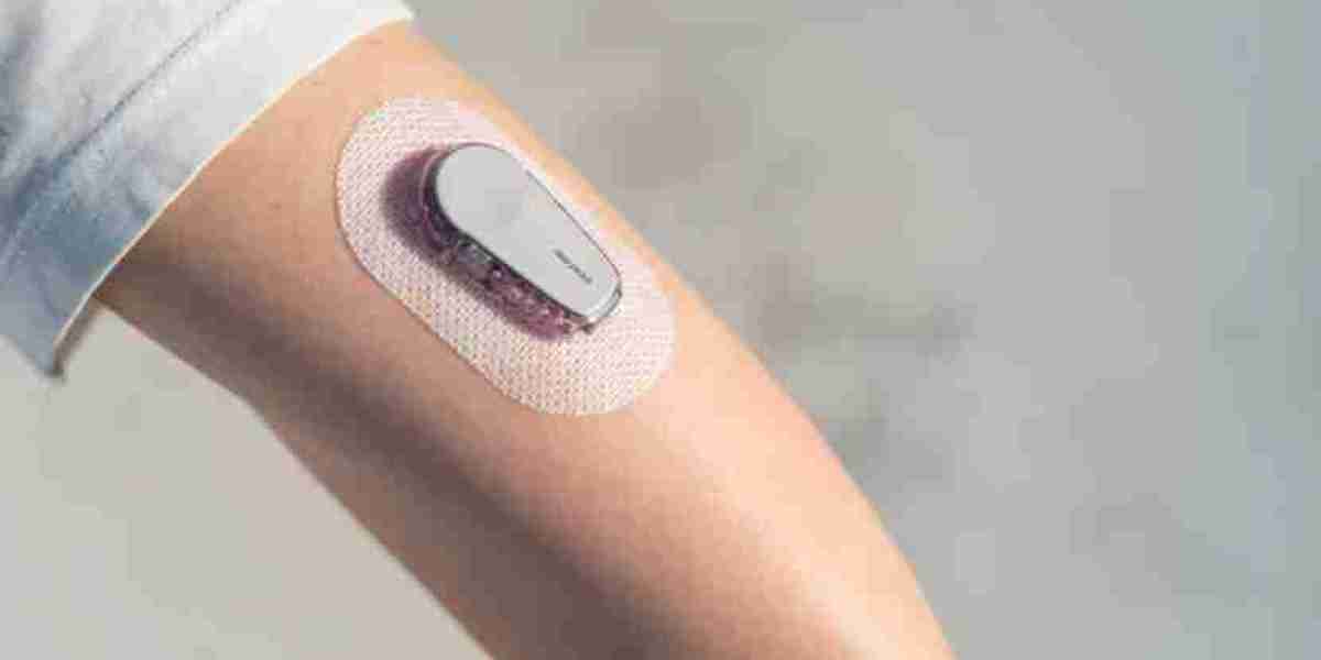 North America Continuous Glucose Monitoring (CGM) Market, Growth, Outlook, Key Insights, 2024 - 2032