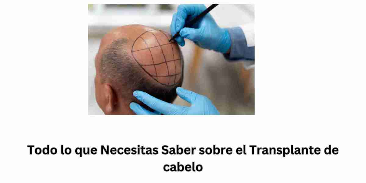 Todo lo que Necesitas Saber sobre el Transplante de cabelo