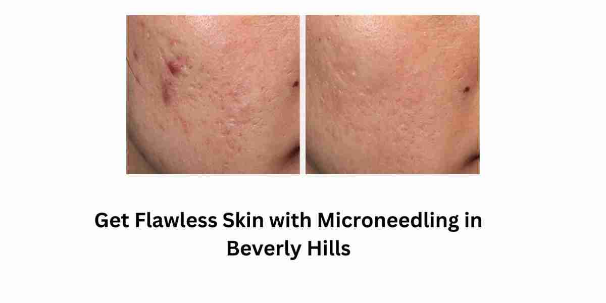 Get Flawless Skin with Microneedling in Beverly Hills