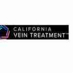 Vein Treatment California