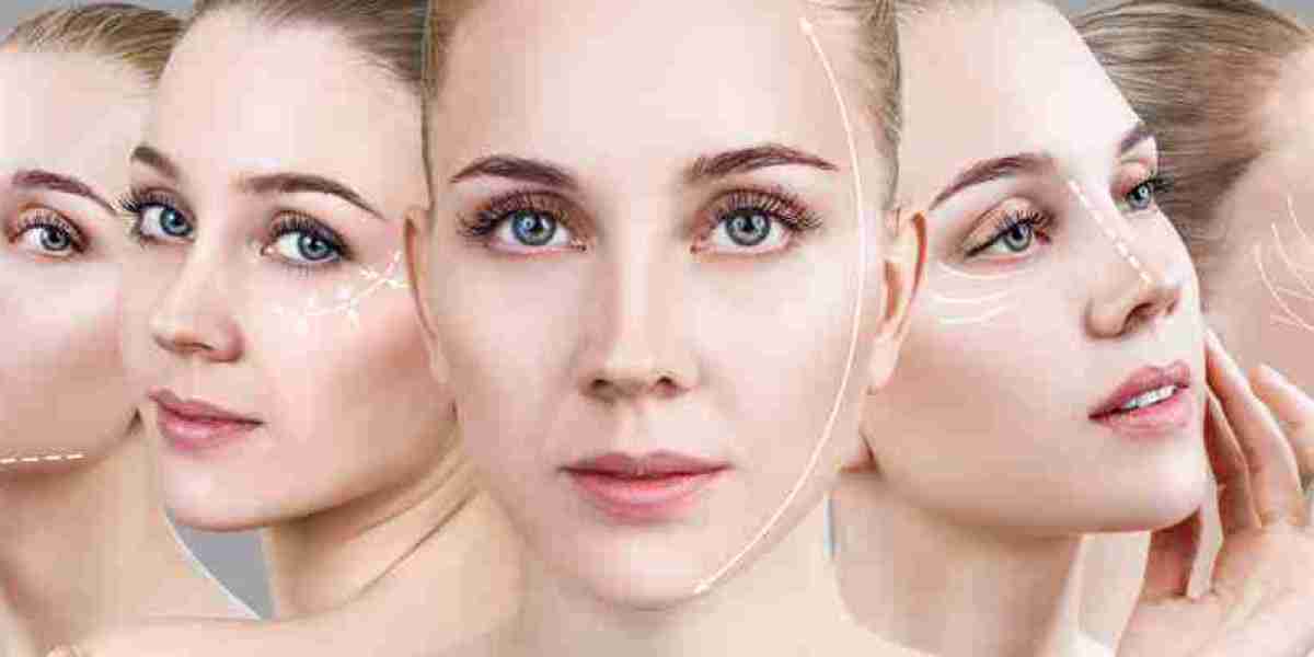 What is a Facelift? A Comprehensive Guide